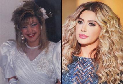 النجمات العرب بين عمليات التجميل والمبالغة